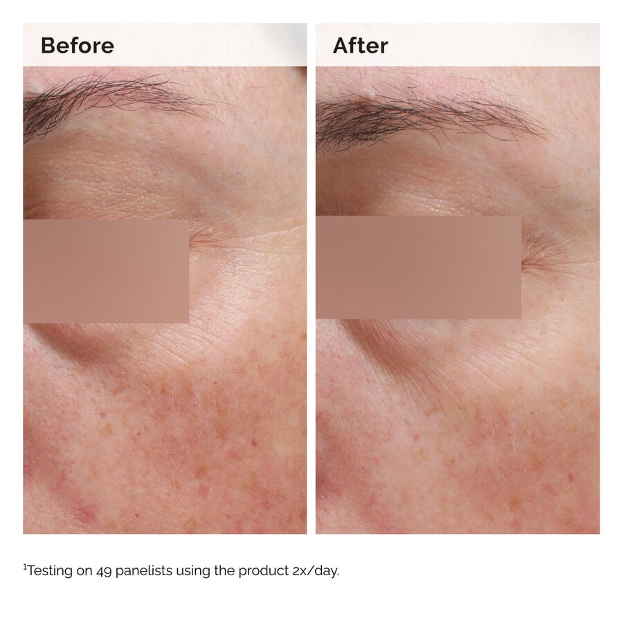 niacinamide-5-face-and-body-emulsion-v5 2024-08-23-ORD-Nia-5pct-Face-Body-B-A-Elasticity-Global-02-1x1.jpg