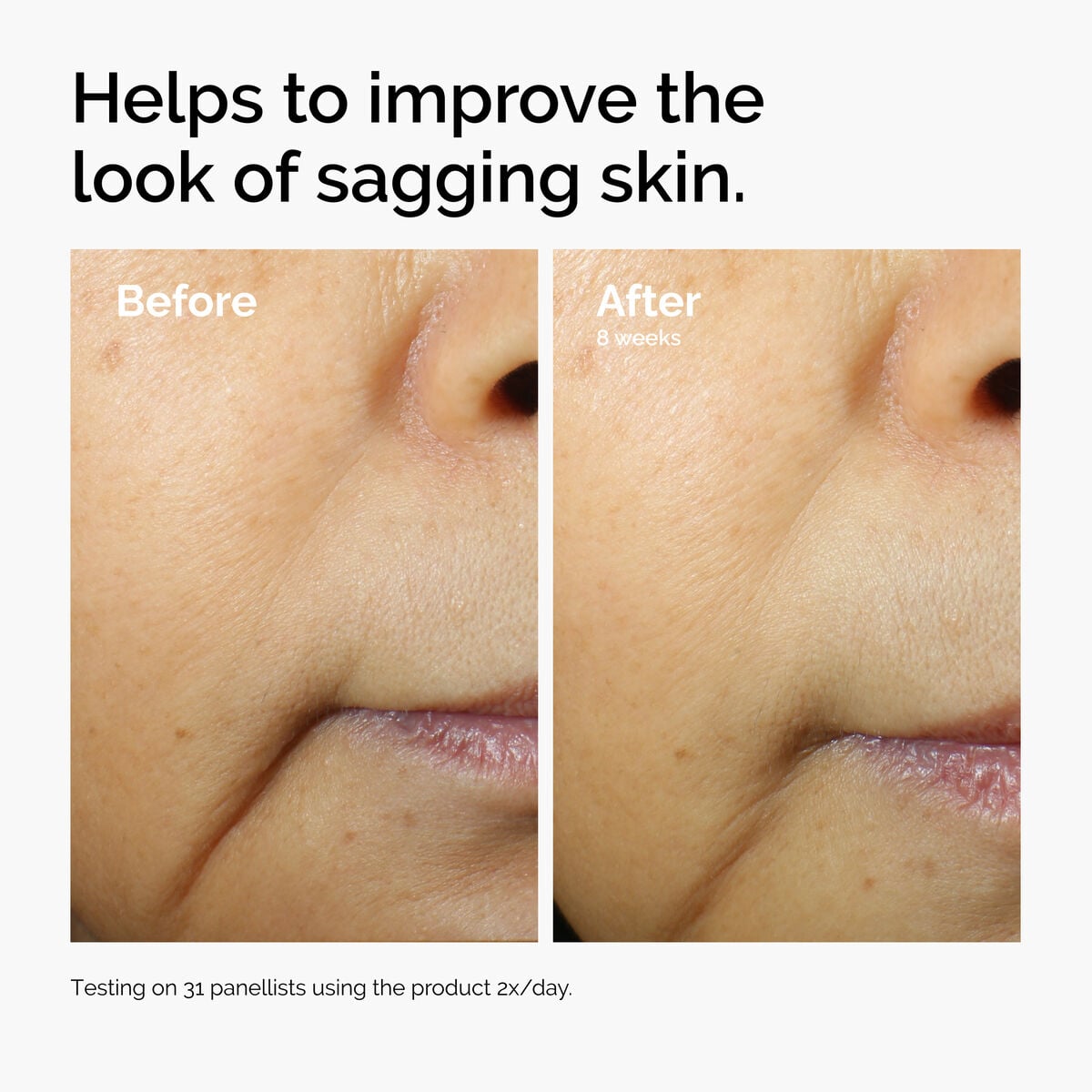 caffeine-3-escin-1-face-serum-f5 ord-caffeine-3pct-escin-1pct-face-serum-before-after-sagging.jpg