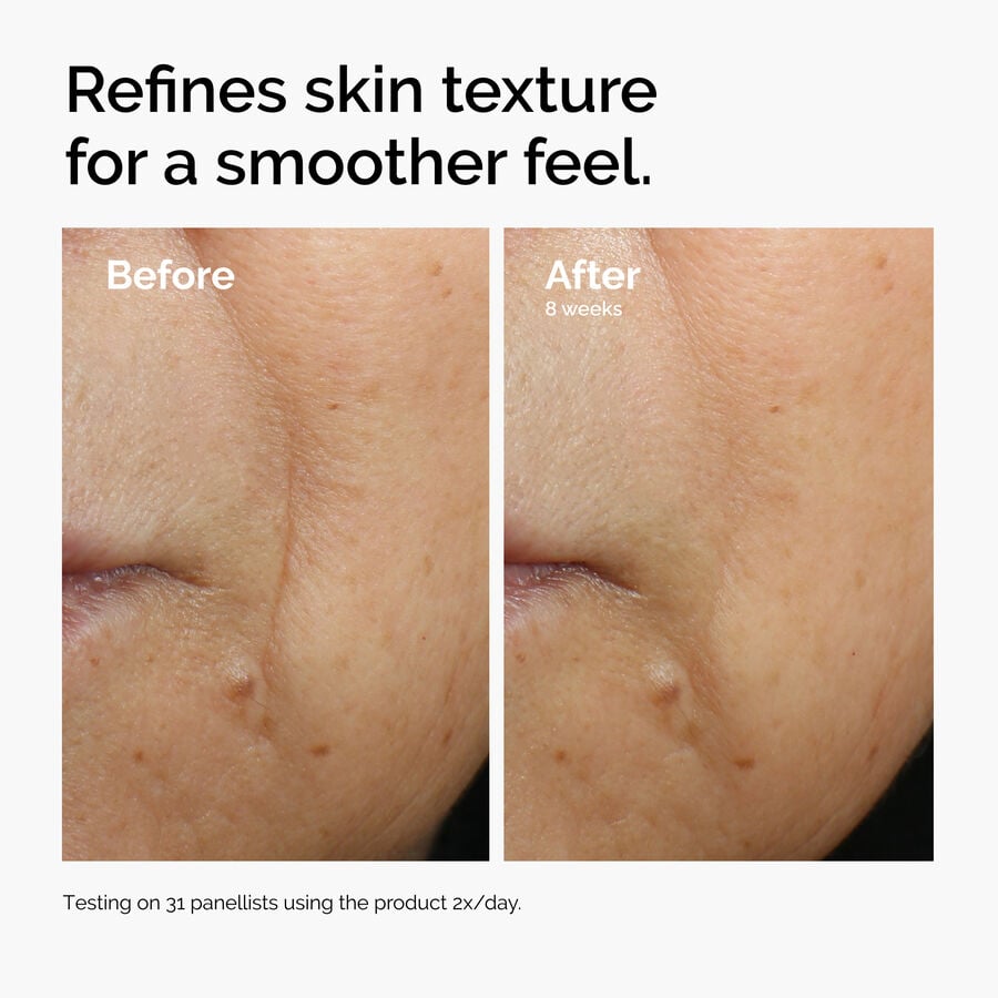 caffeine-3-escin-1-face-serum-f5 ord-caffeine-3pct-escin-1pct-face-serum-before-after-texture.jpg
