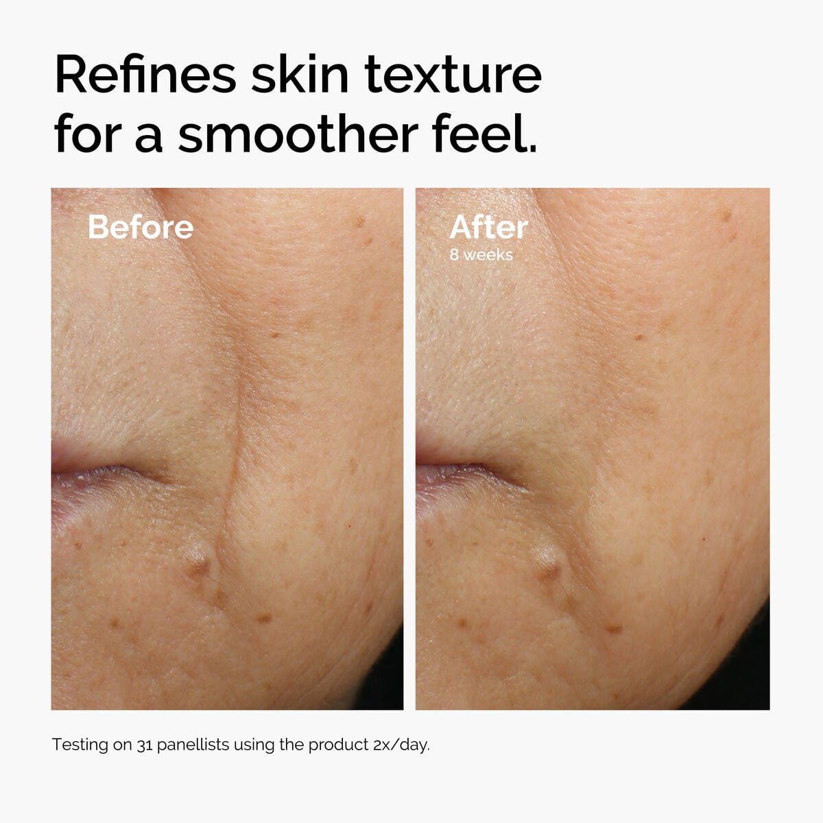 caffeine-3-escin-1-face-serum-f5 ord-caffeine-3pct-escin-1pct-face-serum-before-after-texture.jpg