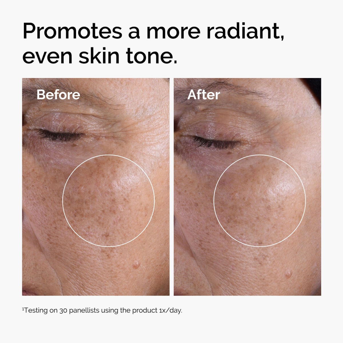 glycolic-acid-7-exfoliating-toner-o8 ord-glycolic-before-after-radiance.jpg