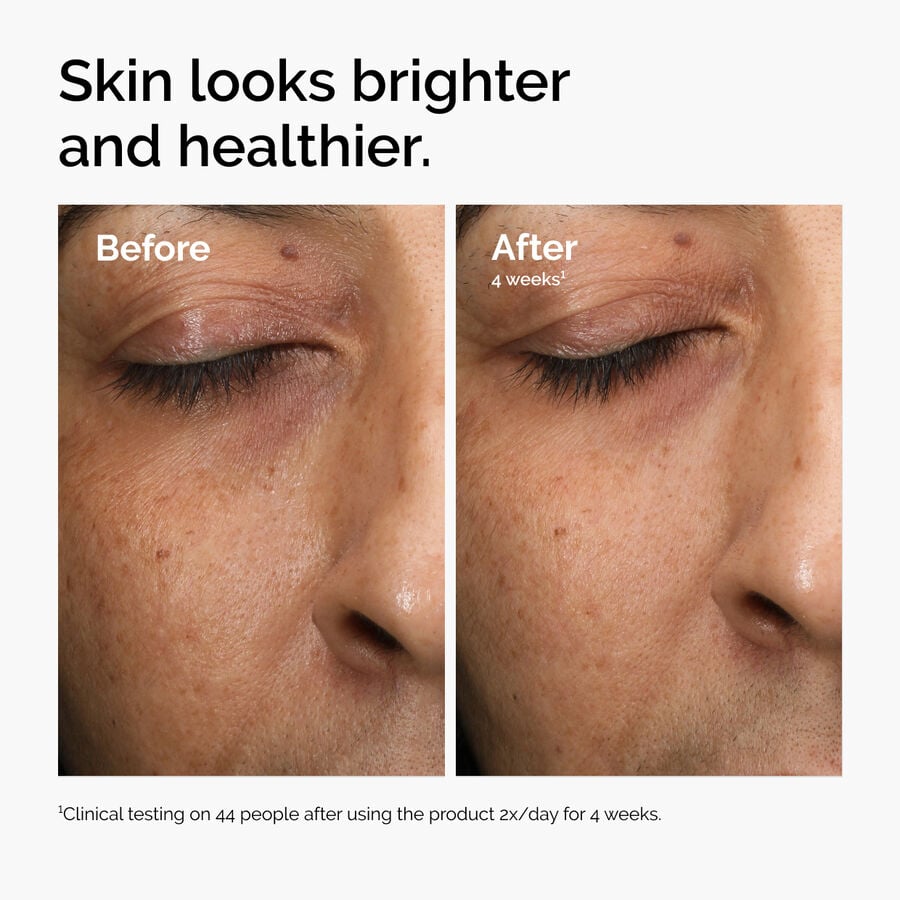 multi-antioxidant-radiance-serum-t0 ord-mars-before-after-healthy.jpg