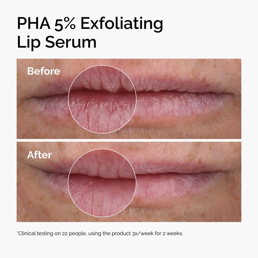 pha-5-exfoliating-lip-serum-s8 ord-pha-5pct-lip-exfoliating-serum-before-after.jpg